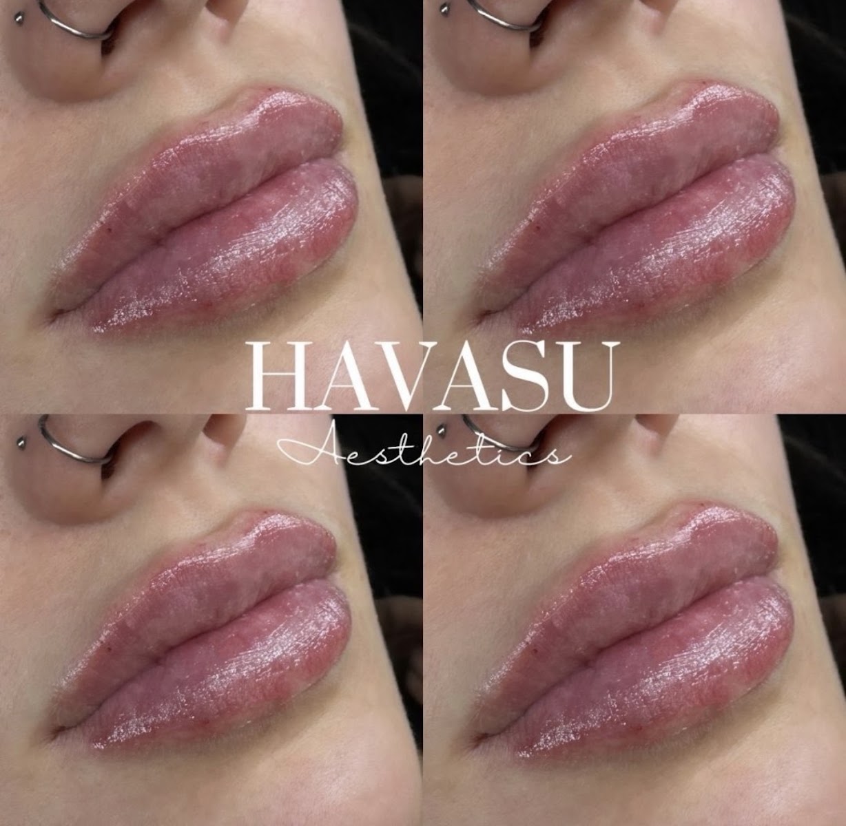 Havasu Aesthetics