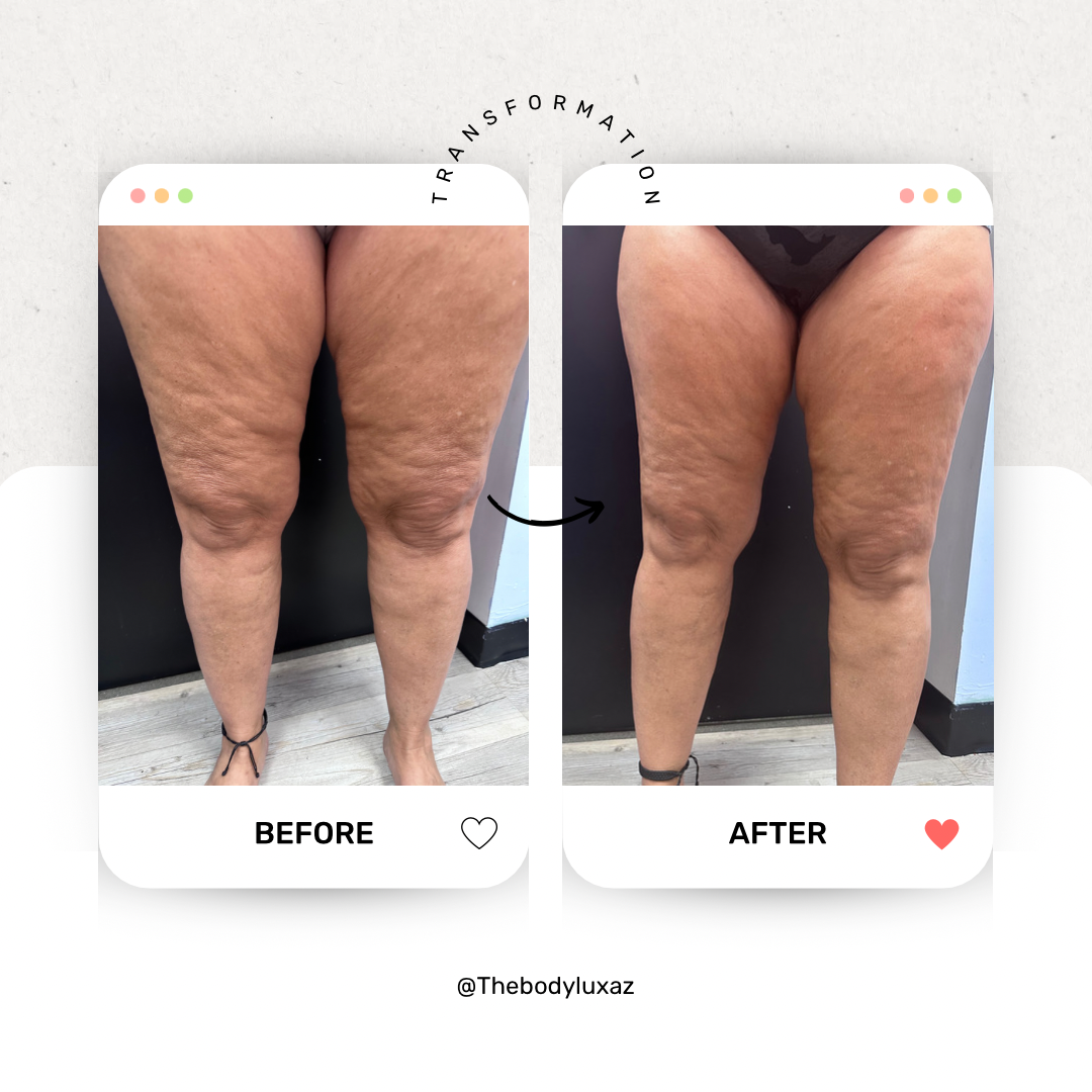 The Body Lux: Brazilian Lymphatic Drainage & Body Contouring